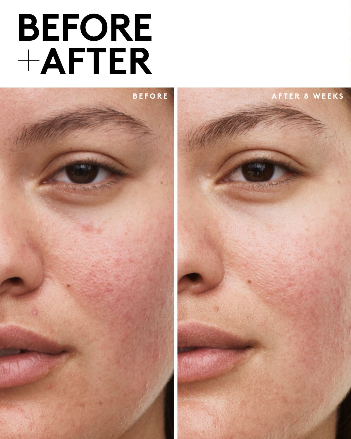 Fenty Skin Vault 5-Piece AM + PM Skincare Essentials - Image 4